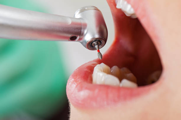 Best Emergency Dentist for Knocked-Out Tooth in Loveland, OH